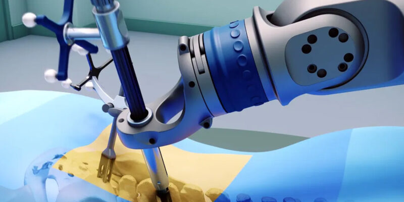 Smarter Spine Surgery How Data Modeling Enhances Multilevel Disc Replacement Decisions 