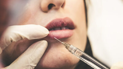 Beyond Wrinkles The Expanding Medical Uses of Botox